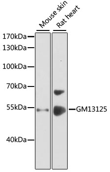 Western blot analysis of extracts of various cell lines using GM13125 Polyclonal Antibody at 1:1000 dilution.