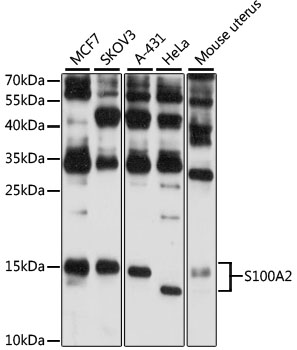 Western blot analysis of extracts of various cell lines using S100A2 Polyclonal Antibody at 1:3000 dilution.