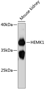 Western blot analysis of extracts of mouse kidney using HEMK1 Polyclonal Antibody at 1:3000 dilution.