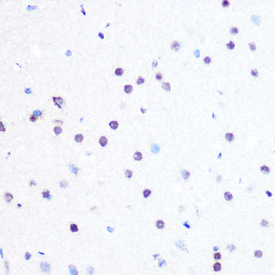 Immunohistochemistry of paraffin-embedded rat brain using PEG3 Polyclonal Antibody at dilution of 1:100 (40x lens).Perform microwave antigen retrieval with 10 mM PBS buffer pH 7.2 before commencing with IHC staining protocol.