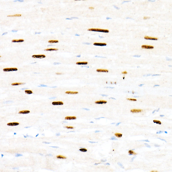 Immunohistochemistry of paraffin-embedded rat heart using FOXP1 Polyclonal Antibody at dilution of 1:20 (40x lens).Perform high pressure antigen retrieval with 10 mM citrate buffer pH 6.0 before commencing with IHC staining protocol.