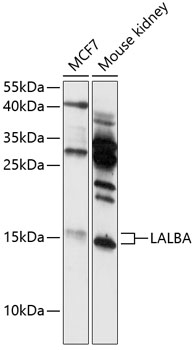 Western blot analysis of extracts of various cell lines using LALBA Polyclonal Antibody at 1:3000 dilution.