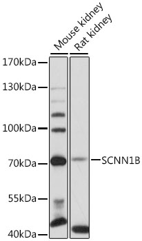 Western blot analysis of extracts of various cell lines using SCNN1B Polyclonal Antibody at 1:3000 dilution.