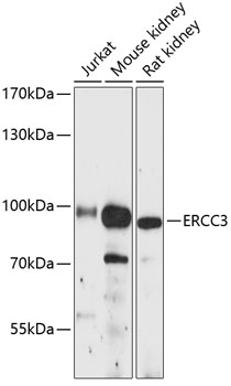 Western blot analysis of extracts of various cell lines using ERCC3 Polyclonal Antibody at 1:3000 dilution.