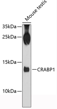 Western blot analysis of extracts of mouse testis using CRABP1 Polyclonal Antibody at 1:3000 dilution.