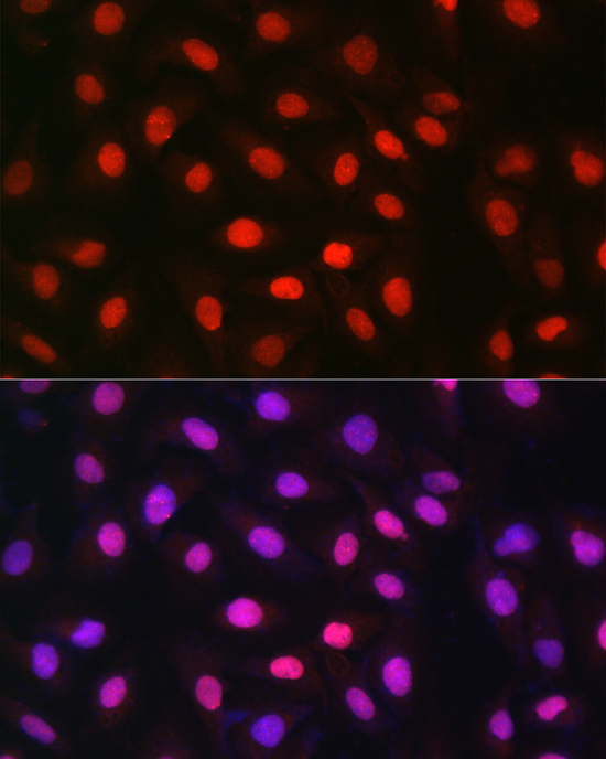 Immunofluorescence analysis of U2OS cells using MDC1 Polyclonal Antibody at dilution of 1:100 (40x lens). Blue: DAPI for nuclear staining.