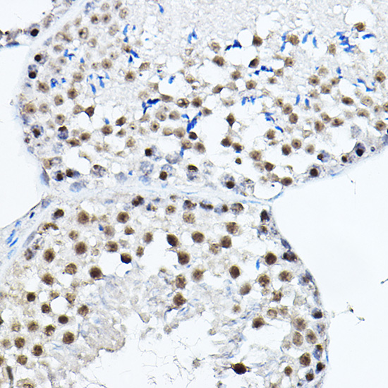 Immunohistochemistry of paraffin-embedded mouse testis using MDC1 Polyclonal Antibody at dilution of 1:100 (40x lens).Perform high pressure antigen retrieval with 10 mM citrate buffer pH 6.0 before commencing with IHC staining protocol.