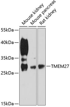 Western blot analysis of extracts of various cell lines using TMEM27 Polyclonal Antibody at 1:3000 dilution.