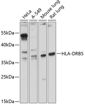 Western blot analysis of extracts of various cell lines using HLA-DRB5 Polyclonal Antibody at 1:3000 dilution.