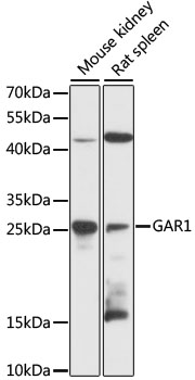 Western blot analysis of extracts of various cell lines using GAR1 Polyclonal Antibody at 1:3000 dilution.