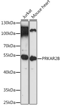 Western blot analysis of extracts of various cell lines using PRKAR2B Polyclonal Antibody at 1:3000 dilution.