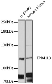 Western blot analysis of extracts of various cell lines using EPB41L3 Polyclonal Antibody at 1:3000 dilution.