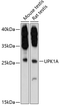 Western blot analysis of extracts of various cell lines using UPK1A Polyclonal Antibody at 1:3000 dilution.