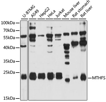 Western blot analysis of extracts of various cell lines using MTHFS Polyclonal Antibody at 1:3000 dilution.