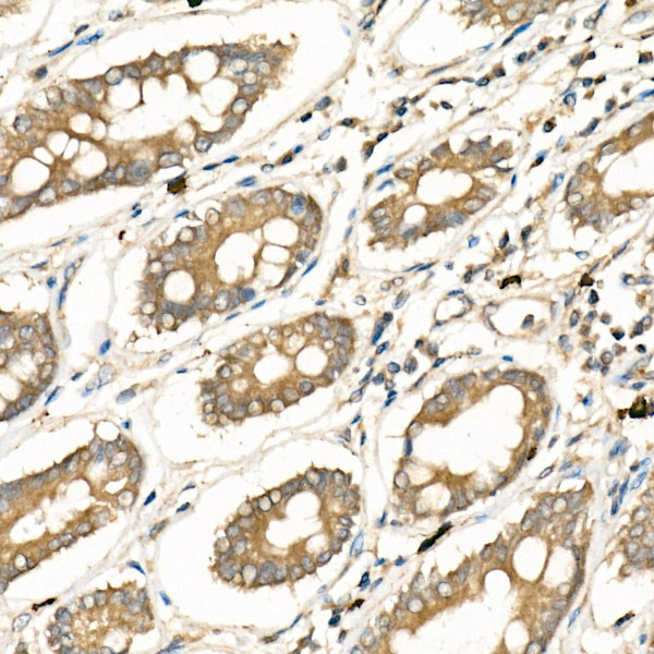 Immunohistochemistry of paraffin-embedded human colon using FZD5 Polyclonal Antibody at dilution of 1:300 (40x lens).Perform high pressure antigen retrieval with 10 mM citrate buffer pH 6.0 before commencing with IHC staining protocol.