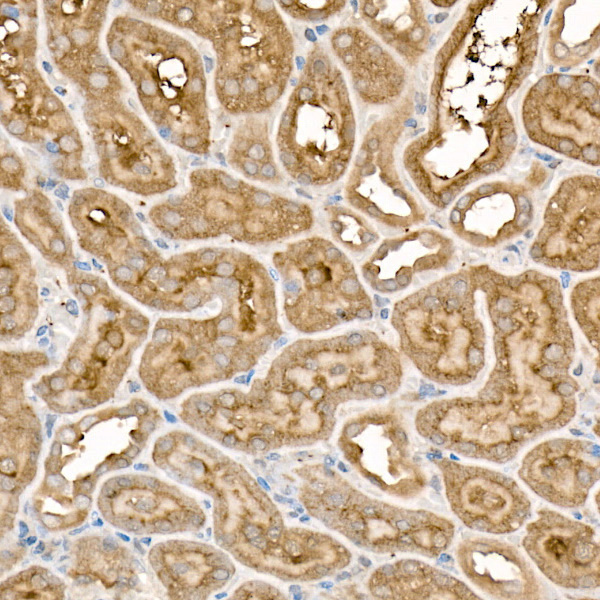 Immunohistochemistry of paraffin-embedded rat kidney using FZD5 Polyclonal Antibody at dilution of 1:300 (40x lens).Perform high pressure antigen retrieval with 10 mM citrate buffer pH 6.0 before commencing with IHC staining protocol.