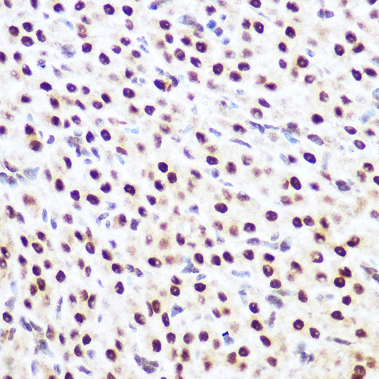 Immunohistochemistry of paraffin-embedded rat ovary using SP3 Polyclonal Antibody at dilution of 1:100 (40x lens).Perform microwave antigen retrieval with 10 mM Tris/EDTA buffer pH 9.0 before commencing with IHC staining protocol.