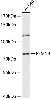 Western blot analysis of extracts of A-549 cells using FEM1B Polyclonal Antibody at 1:3000 dilution.