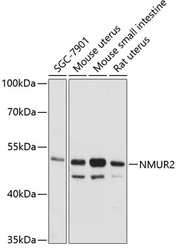 Western blot analysis of extracts of various cell lines using NMUR2 Polyclonal Antibody at 1:3000 dilution.