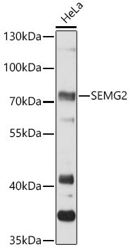 Western blot analysis of extracts of HeLa using SEMG2 Polyclonal Antibody at 1:3000 dilution.