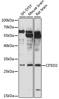 Western blot analysis of extracts of various cell lines using CITED2 Polyclonal Antibody at 1:3000 dilution.