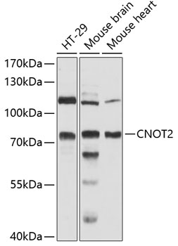 Western blot analysis of extracts of various cell lines using CNOT2 Polyclonal Antibody at 1:3000 dilution.