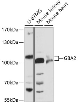 Western blot analysis of extracts of various cell lines using GBA2 Polyclonal Antibody at 1:3000 dilution.