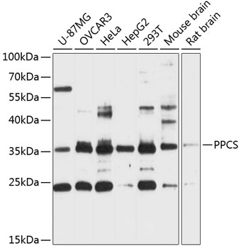 Western blot analysis of extracts of various cell lines using PPCS Polyclonal Antibody at 1:3000 dilution.