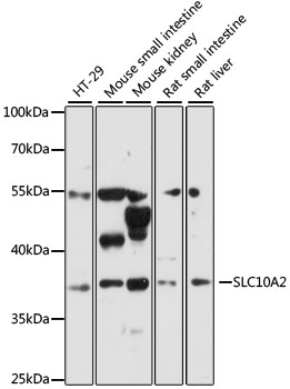 Western blot analysis of extracts of various cell lines using SLC10A2 Polyclonal Antibody at 1:3000 dilution.