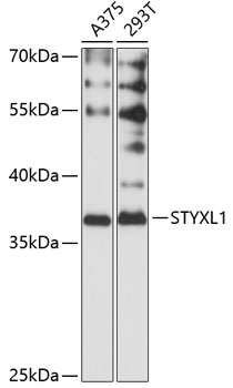 Western blot analysis of extracts of various cell lines using STYXL1 Polyclonal Antibody at 1:3000 dilution.