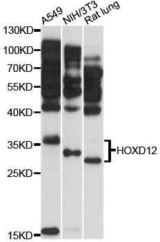 Western blot analysis of extracts of various cell lines using HOXD12 Polyclonal Antibody at 1:3000 dilution.