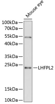 Western blot analysis of extracts of mouse eye using LHFPL2 Polyclonal Antibody at 1:3000 dilution.