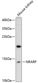 Western blot analysis of extracts of mouse kidney using NRARP Polyclonal Antibody at 1:3000 dilution.