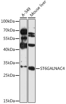 Western blot analysis of extracts of various cell lines using ST6GALNAC4 Polyclonal Antibody at 1:3000 dilution.