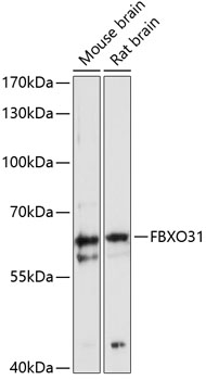 Western blot analysis of extracts of various cell lines using FBXO31 Polyclonal Antibody at 1:3000 dilution.