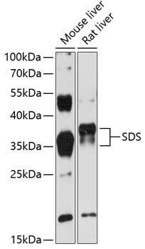 Western blot analysis of extracts of various cell lines using SDS Polyclonal Antibody at 1:3000 dilution.