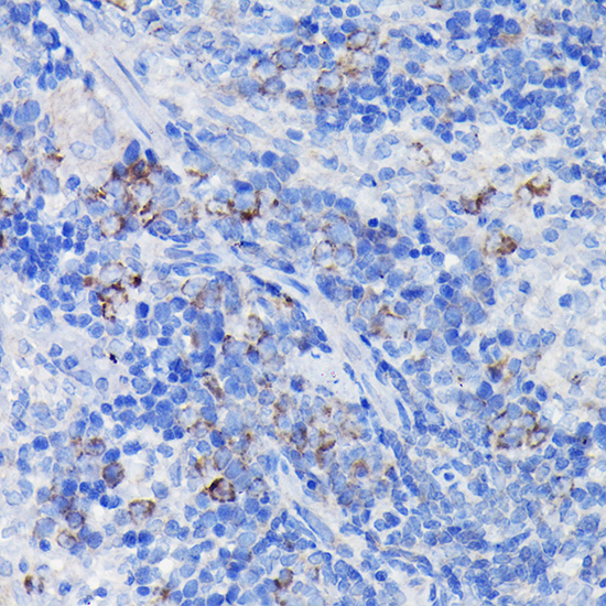 Immunohistochemistry of paraffin-embedded rat spleen using Clusterin alpha chain Polyclonal Antibody at dilution of 1:100 (40x lens).Perform high pressure antigen retrieval with 10 mM citrate buffer pH 6.0 before commencing with IHC staining protocol.