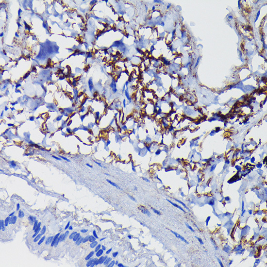 Immunohistochemistry of paraffin-embedded human lung using Clusterin alpha chain Polyclonal Antibody at dilution of 1:100 (40x lens).Perform high pressure antigen retrieval with 10 mM citrate buffer pH 6.0 before commencing with IHC staining protocol.