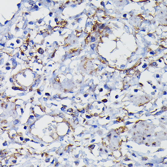 Immunohistochemistry of paraffin-embedded human esophageal using Clusterin alpha chain Polyclonal Antibody at dilution of 1:100 (40x lens).Perform high pressure antigen retrieval with 10 mM citrate buffer pH 6.0 before commencing with IHC staining protocol.