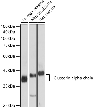 Western blot analysis of extracts of various cell lines using Clusterin alpha chain Polyclonal Antibody at 1:1000 dilution.