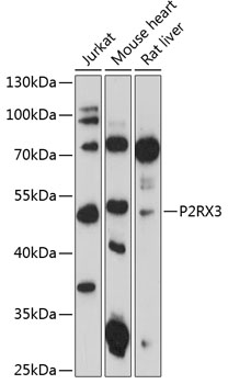 Western blot analysis of extracts of various cell lines using P2RX3 Polyclonal Antibody at 1:3000 dilution.