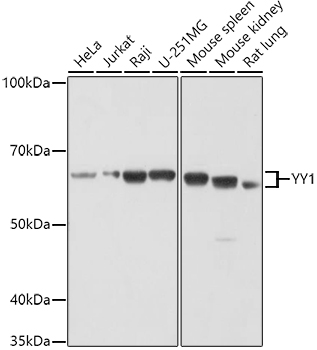 Western blot analysis of extracts of various cell lines using YY1 Polyclonal Antibody at 1:1000 dilution.