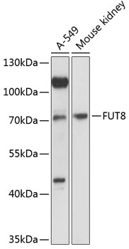 Western blot analysis of extracts of various cell lines using FUT8 Polyclonal Antibody at 1:3000 dilution.