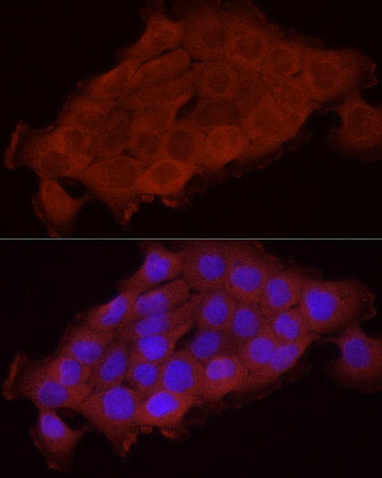 Immunofluorescence analysis of A431 cells using SFRP2 Polyclonal Antibody at dilution of 1:50 (40x lens). Blue: DAPI for nuclear staining.