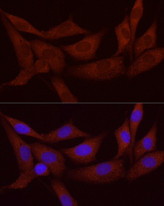 Immunofluorescence analysis of NIH/3T3 cells using SFRP2 Polyclonal Antibody at dilution of 1:50 (40x lens). Blue: DAPI for nuclear staining.