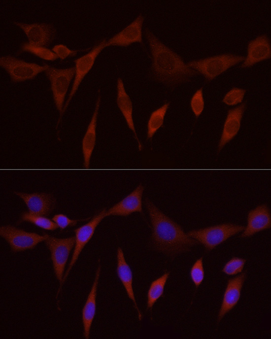 Immunofluorescence analysis of PC-12 cells using SFRP2 Polyclonal Antibody at dilution of 1:50 (40x lens). Blue: DAPI for nuclear staining.