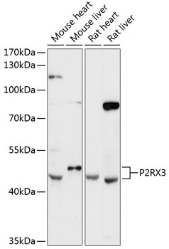 Western blot analysis of extracts of various cell lines using P2RX3 Polyclonal Antibody at 1:3000 dilution.