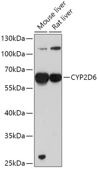 Western blot analysis of extracts of various cell lines using CYP2D6 Polyclonal Antibody at 1:1000 dilution.