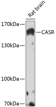 Western blot analysis of extracts of rat brain using CASR Polyclonal Antibody at 1:1000 dilution.