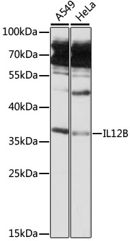 Western blot analysis of extracts of various cell lines using IL12B Polyclonal Antibody at 1:3000 dilution.